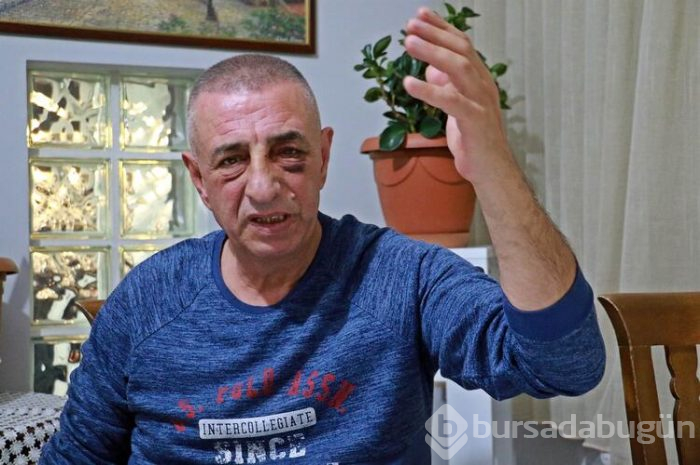 Apartman yöneticisi öldüresiye dövüldü!
