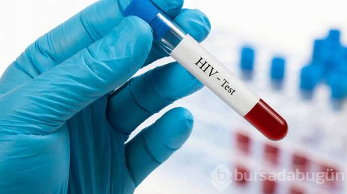 19 yıl sonra keşfedilen yeni HIV virüsü!