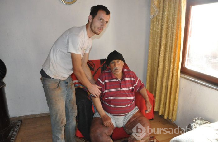 Çürüyen bacaklarını kurtlar yiyor!