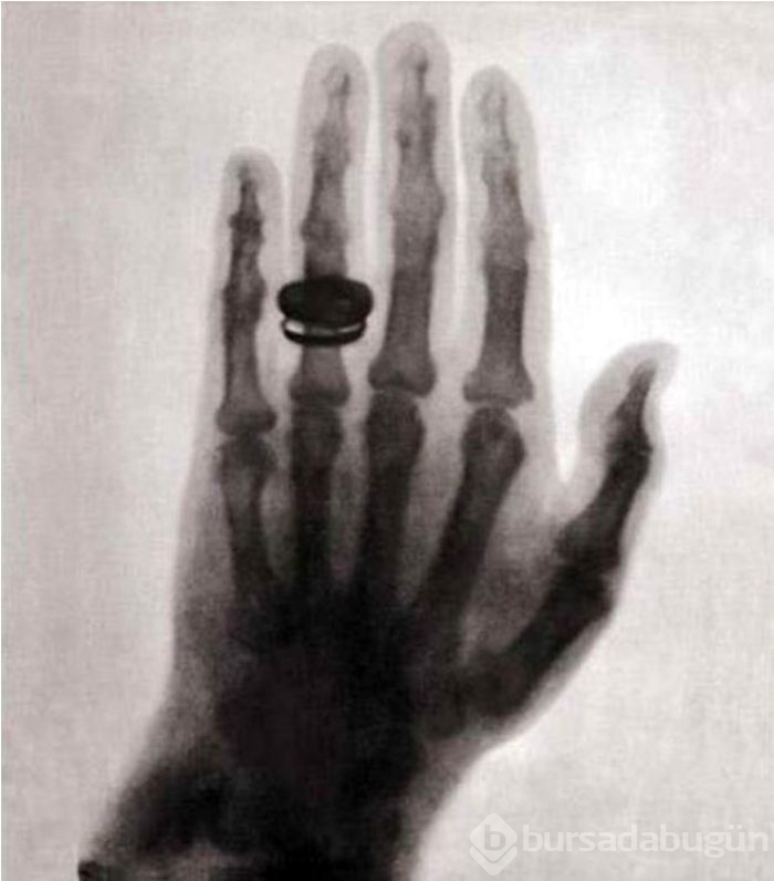 124 yıl önce çekilen ilk röntgendeki ilginç detay!