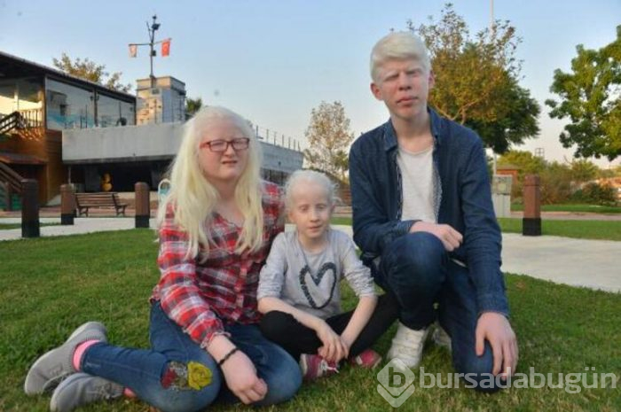 Albinolar ilaç statüsünde güneş kremi istiyorlar!