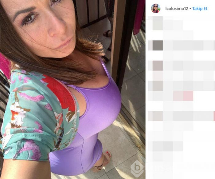Estetik skandalı! Popo kaldırma ameliyatı olacaktı...