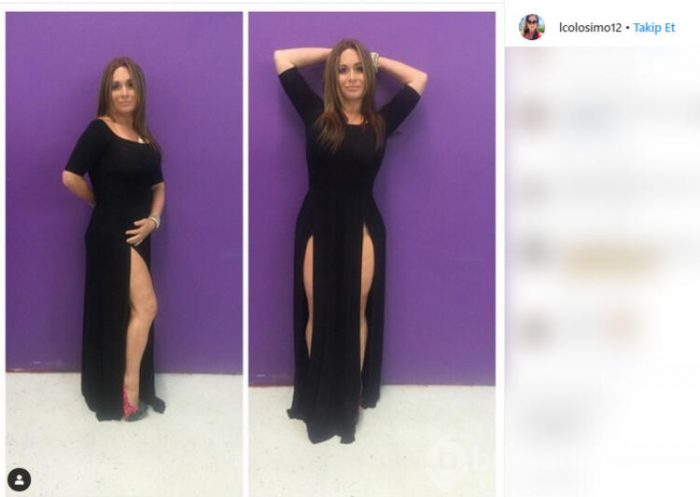 Estetik skandalı! Popo kaldırma ameliyatı olacaktı...