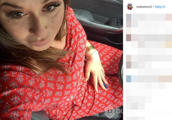 Estetik skandalı! Popo kaldırma ameliyatı olacaktı...