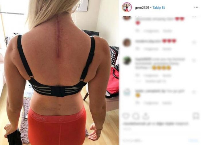 Bikini modelinden kahreden haber!