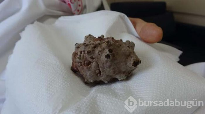 Doktorlar bile şaşırdı! 'Kendimi hafiflemiş hissediyorum'