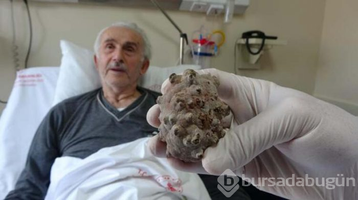 Doktorlar bile şaşırdı! 'Kendimi hafiflemiş hissediyorum'