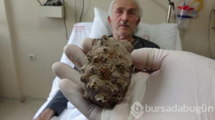 Doktorlar bile şaşırdı! 'Kendimi hafiflemiş hissediyorum'
