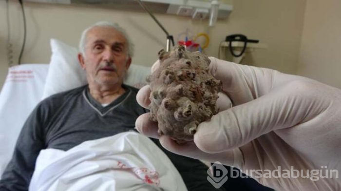 Doktorlar bile şaşırdı! 'Kendimi hafiflemiş hissediyorum'