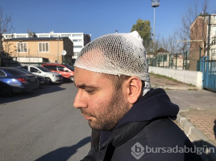 TEM otoyolunda gaspçı şoku!