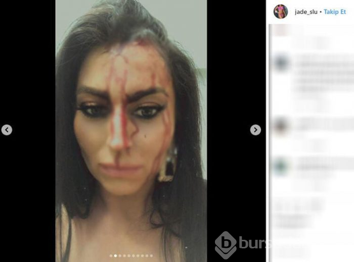 Güzellik kraliçesi kanlar içinde! Kafasında patladı...