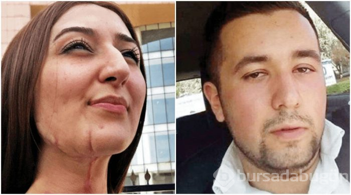 Kadın hayatta kaldı ve her şeyi anlattı! Kesti, tecavüz etti, bağladı, ezdi... 