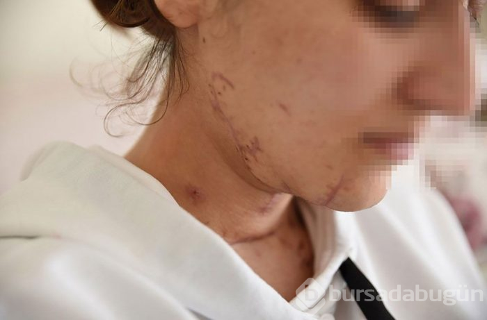 Kadın hayatta kaldı ve her şeyi anlattı! Kesti, tecavüz etti, bağladı, ezdi... 