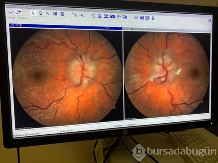 Altı yıldır kullanıyordu... Doktordan duydukları karşısında şoke oldu!
