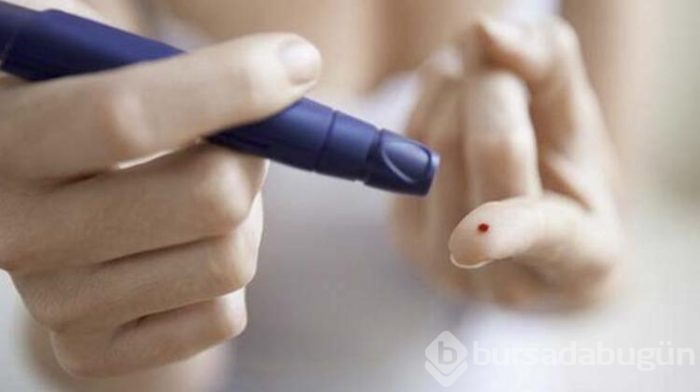 Neden fıstık ezmesi tüketmelisiniz?