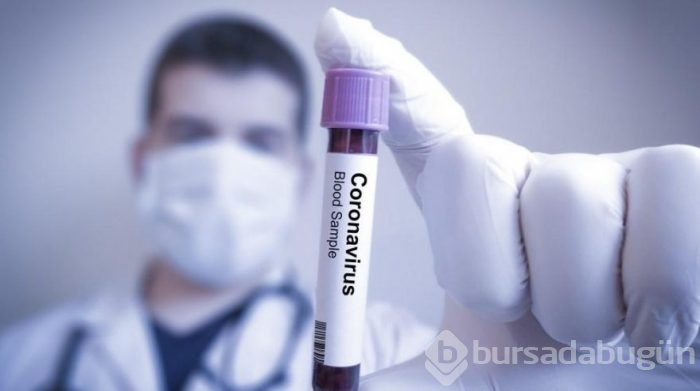 'Corona virüsü' nedir, nasıl bulaşır, tedavisi var mı?