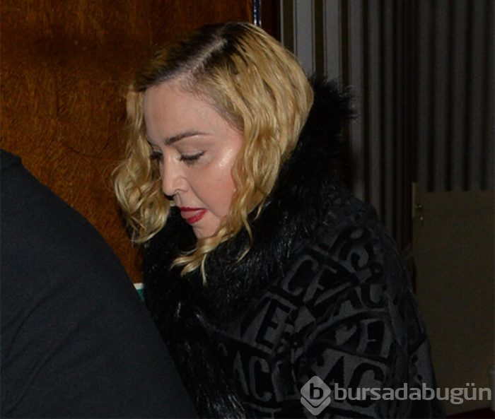 Madonna'nın yüzündeki şişlik dikkat çekti 