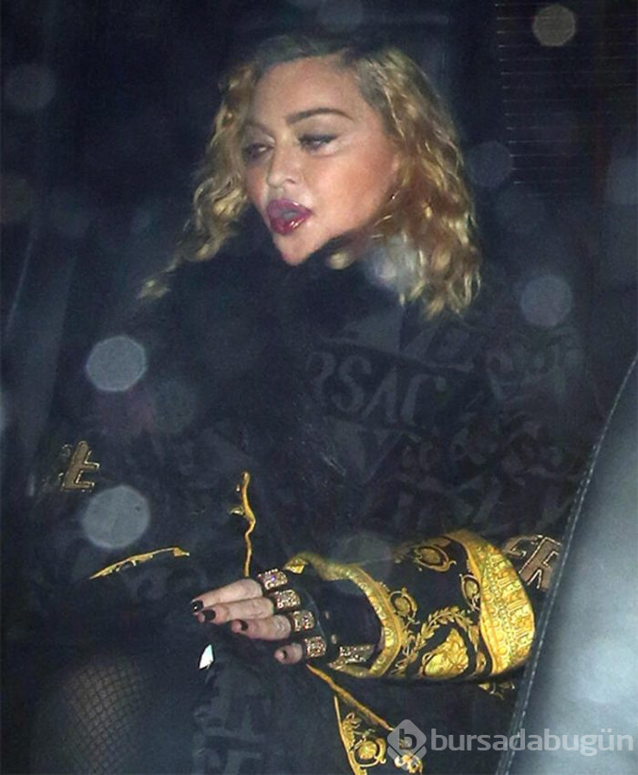 Madonna'nın yüzündeki şişlik dikkat çekti 