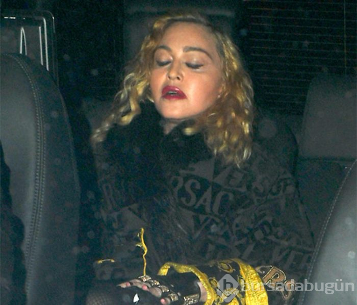 Madonna'nın yüzündeki şişlik dikkat çekti 