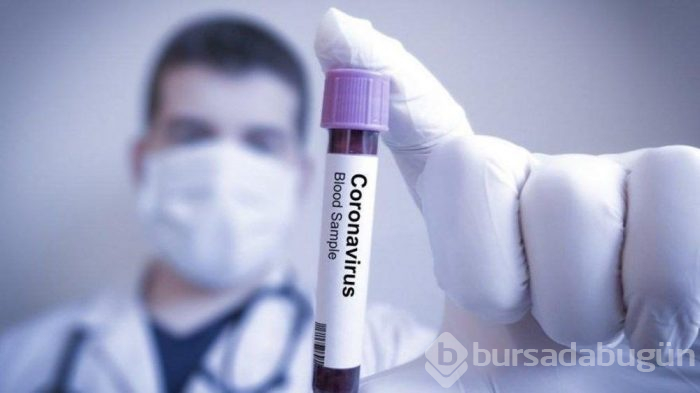  25 soruyla Corona virüs