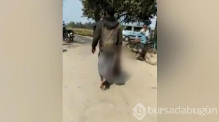 Eşinin kesik kafası ile karakola yürüdü!