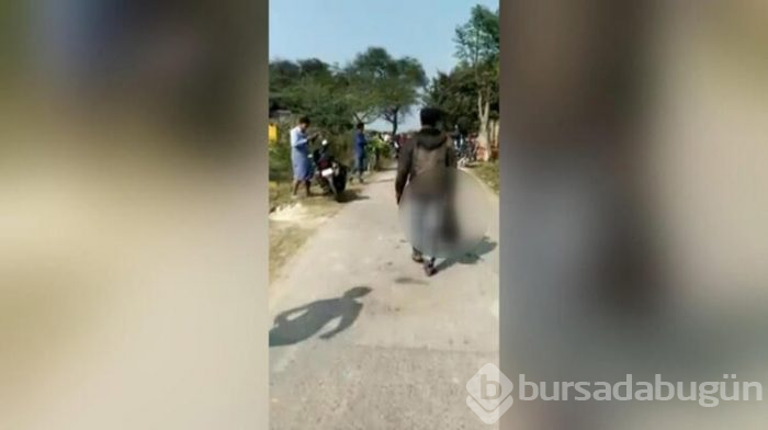 Eşinin kesik kafası ile karakola yürüdü!