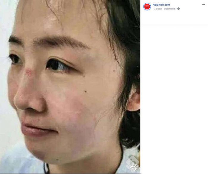 Coronavirüsüyle mücadele eden doktorların fedakarlık izi