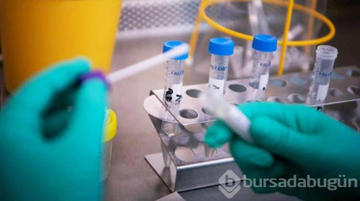 Corona virüsü iddiası! Tedavisinde son durum 