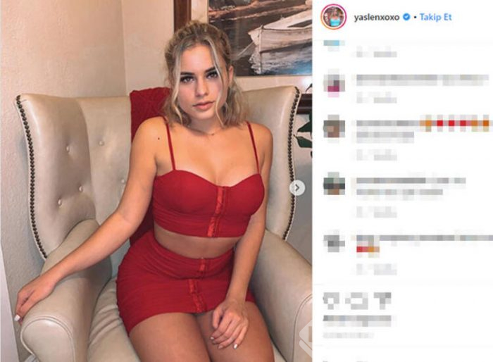 Hastalığını küçükken saklıyormuş! 'Arkadaşlarım sürekli alay ediyordu!'