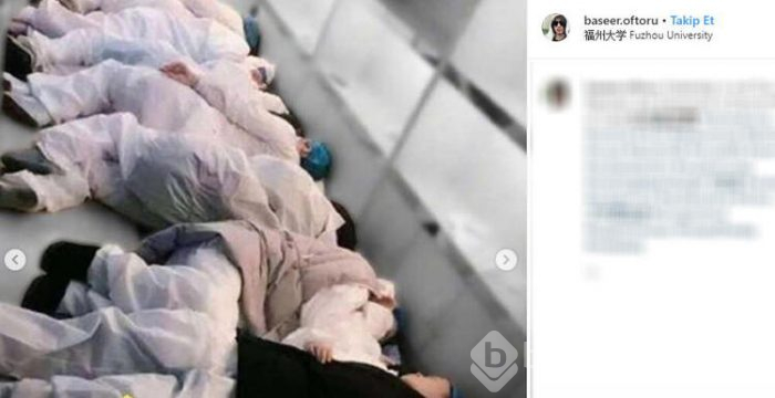 Doktorlar ve hemşireler saçlarını kazıtıyor!