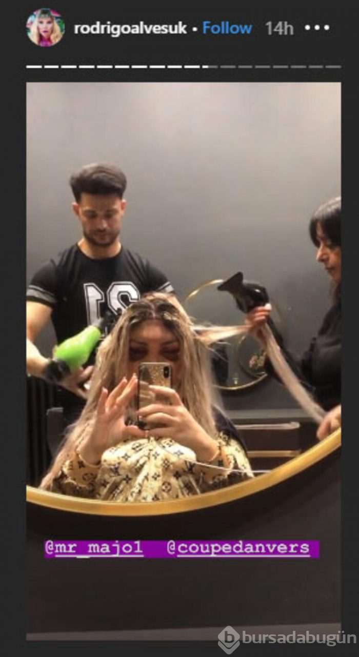 Yüzündeki morluklarla kuaföre koştu