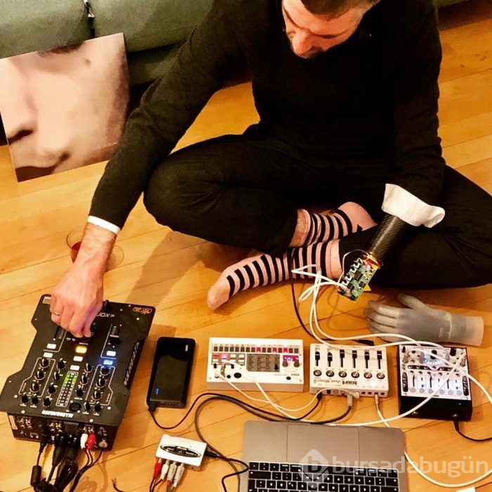  Protez kolla müzik aleti çalıyor
