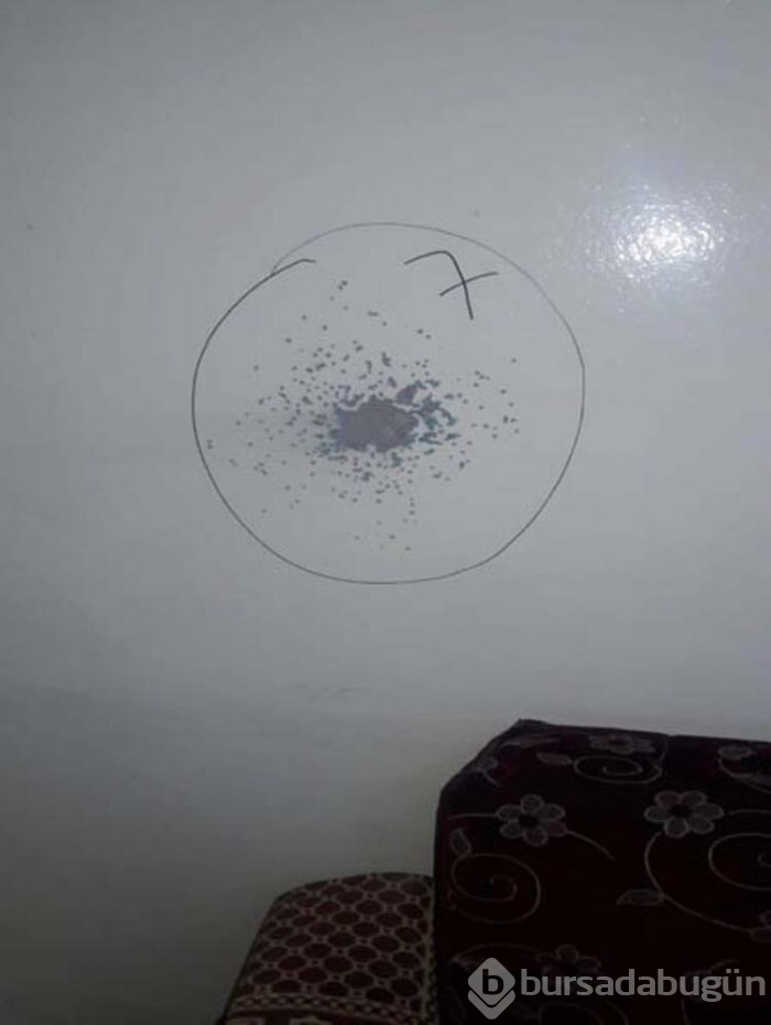  Av tüfeğiyle kocası tarafından vurulan genç kadın gözünü kaybetti!