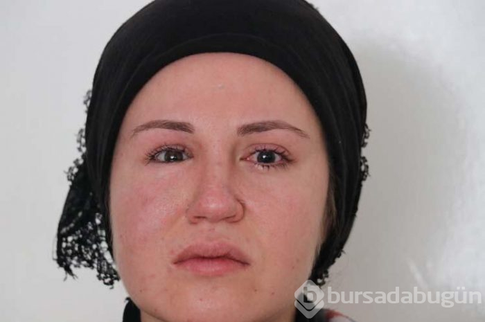  Av tüfeğiyle kocası tarafından vurulan genç kadın gözünü kaybetti!