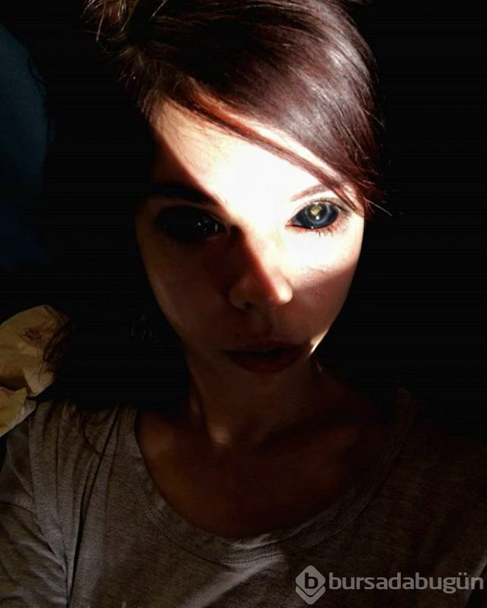 Şarkıcıya özenip gözlerine dövme yaptırdı! Sonu kötü bitti...