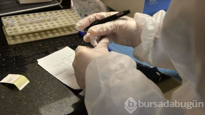 Corana virüsten şüphelendiğinizde işte yapmanız gerekenler! 