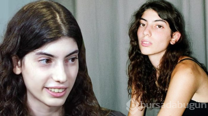 Ünlü model ilk kez anlattı: Annemi aradım çığlık atmaya başladım! 