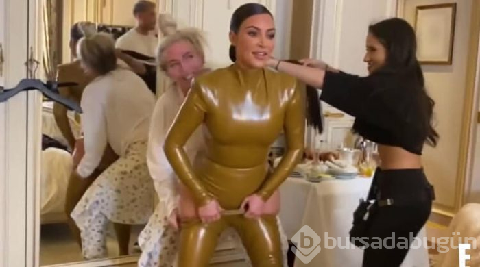 Kim Kardashian: "Canım yanıyor"