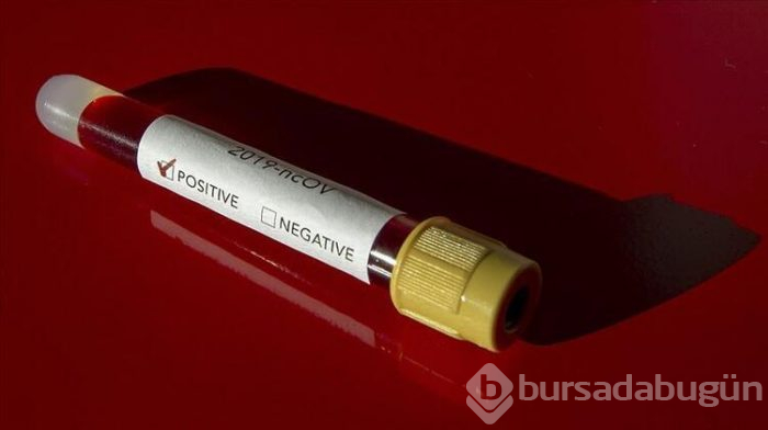 Corona virüsü (koronavirüs) ne zaman bitecek?