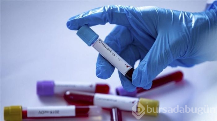 Koronavirüsten ölenlerin sayısı 60 bini aştı