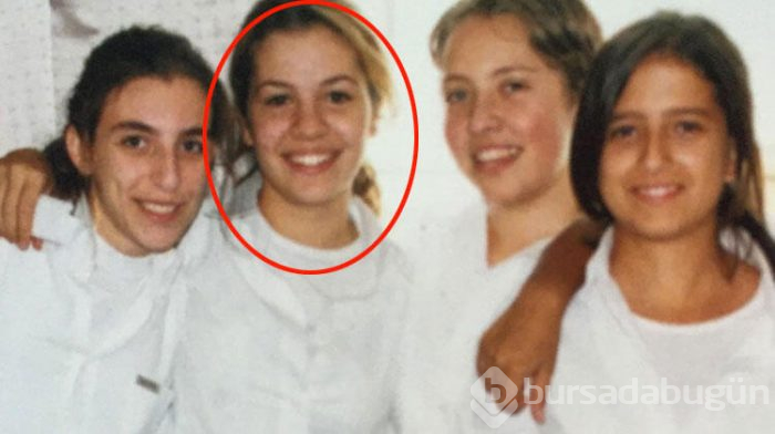 Kekemeliği yenmedim kabullendim