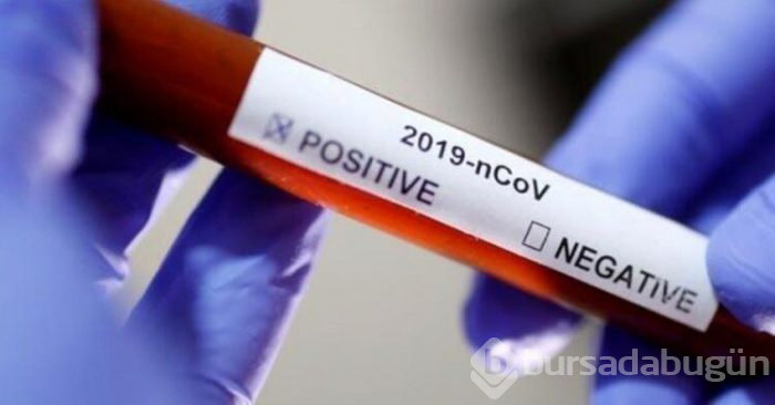 Kaplanın corona virüs testi pozitif çıktı!
