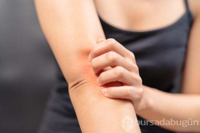 Koronavirüsten korunurken tetiklenen cilt sorunları 