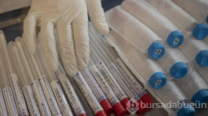 Bu sıralar sıkça duyduğumuz 'entübe' ne demek?