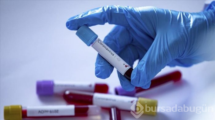 Yalnızca dört saatte sonuç veren test geliştirildi