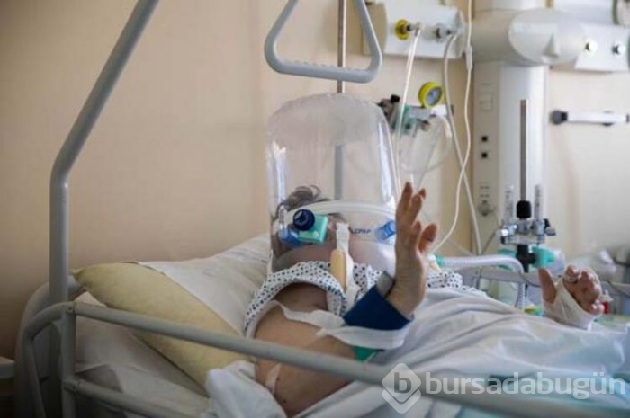 İşte koronavirüsün yeni belirtileri