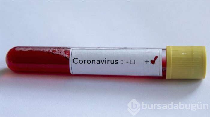 Hayvanlardaki virüs neden kolayca insana geçiyor?