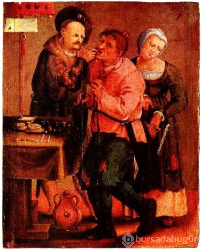 Tütün ile lavman yaptılar! İşte tarihin en korkunç 7 tedavi yöntemi