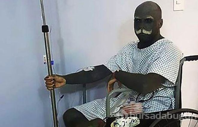 32 yaşındaki adam 'Estetik durmuyor' diyerek erkeklik organını aldırdı