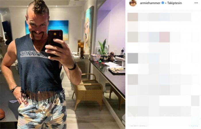  Armie Hammer değişti! 